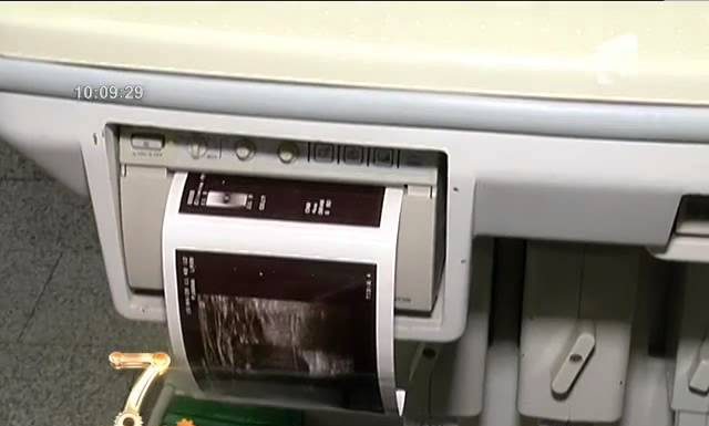 Tratarea vaselor de sânge sparte de pe picioare