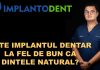 IMPLANTUL DENTAR, LA FEL DE BUN CA DINTELE NATURAL?