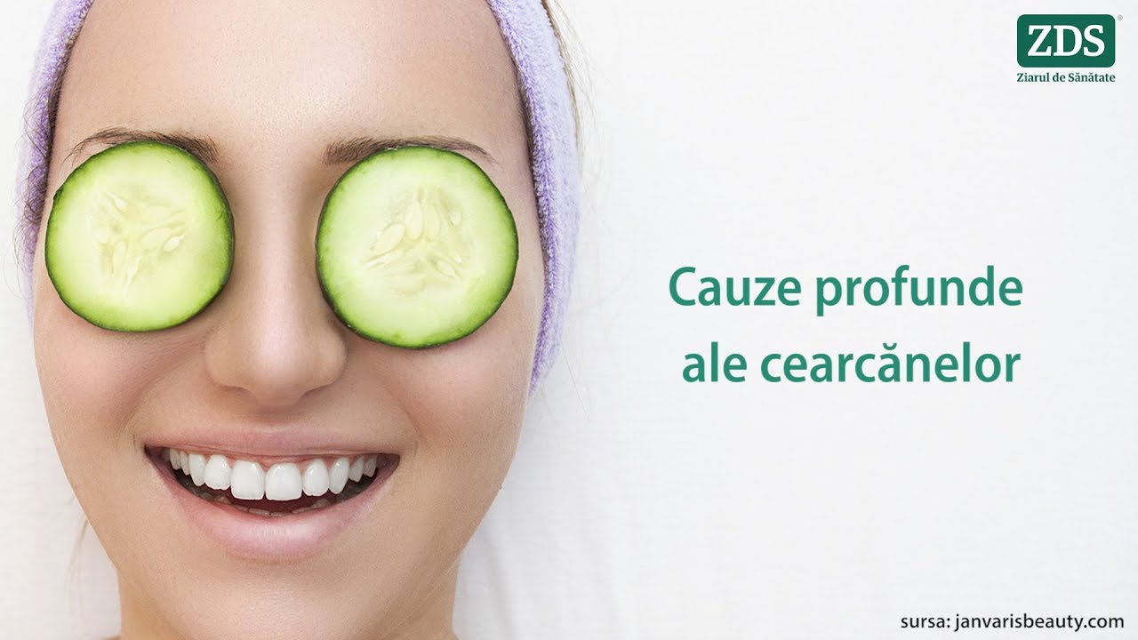 CARE POT FI CAUZELE CEARCĂNELOR? Traieste sanatos cu Simona