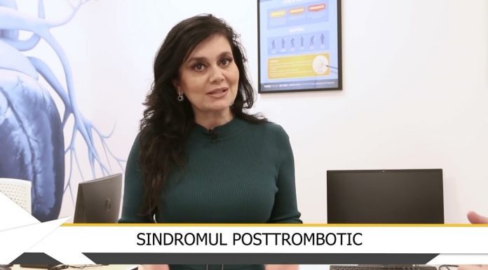 SINDROMUL POSTTROMBOTIC