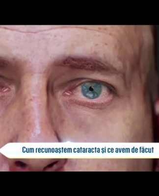 Bună dimineața, Sănătate! CATARACTA