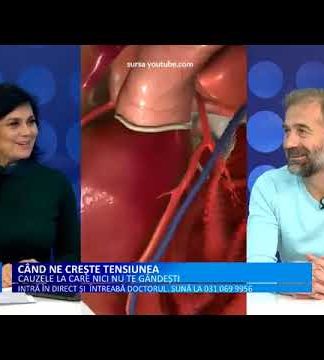 Doctor Medika TRATAMENTUL ENDOVASCULAR AL HIPERTENSIUNII ARTERIALE