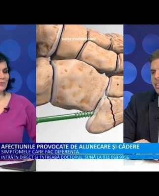 Doctor Medika FRACTURI, LUXATII